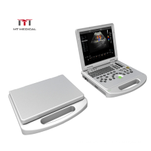 High Configuration 3D 4D Color Doppler Laptop Portable Cardiac Ultrasound Machine